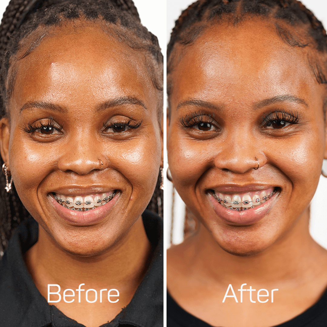 Skin Brightening Glutathione Supplement