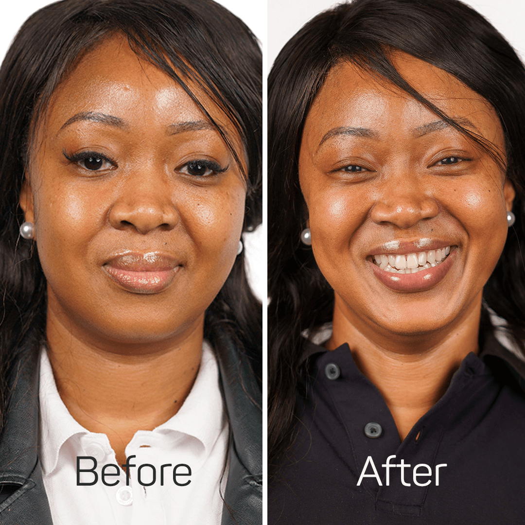 UltiGlow – Skin Brightening Serum – 30ml