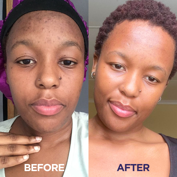 Ultra Skin Brightening Collagen
