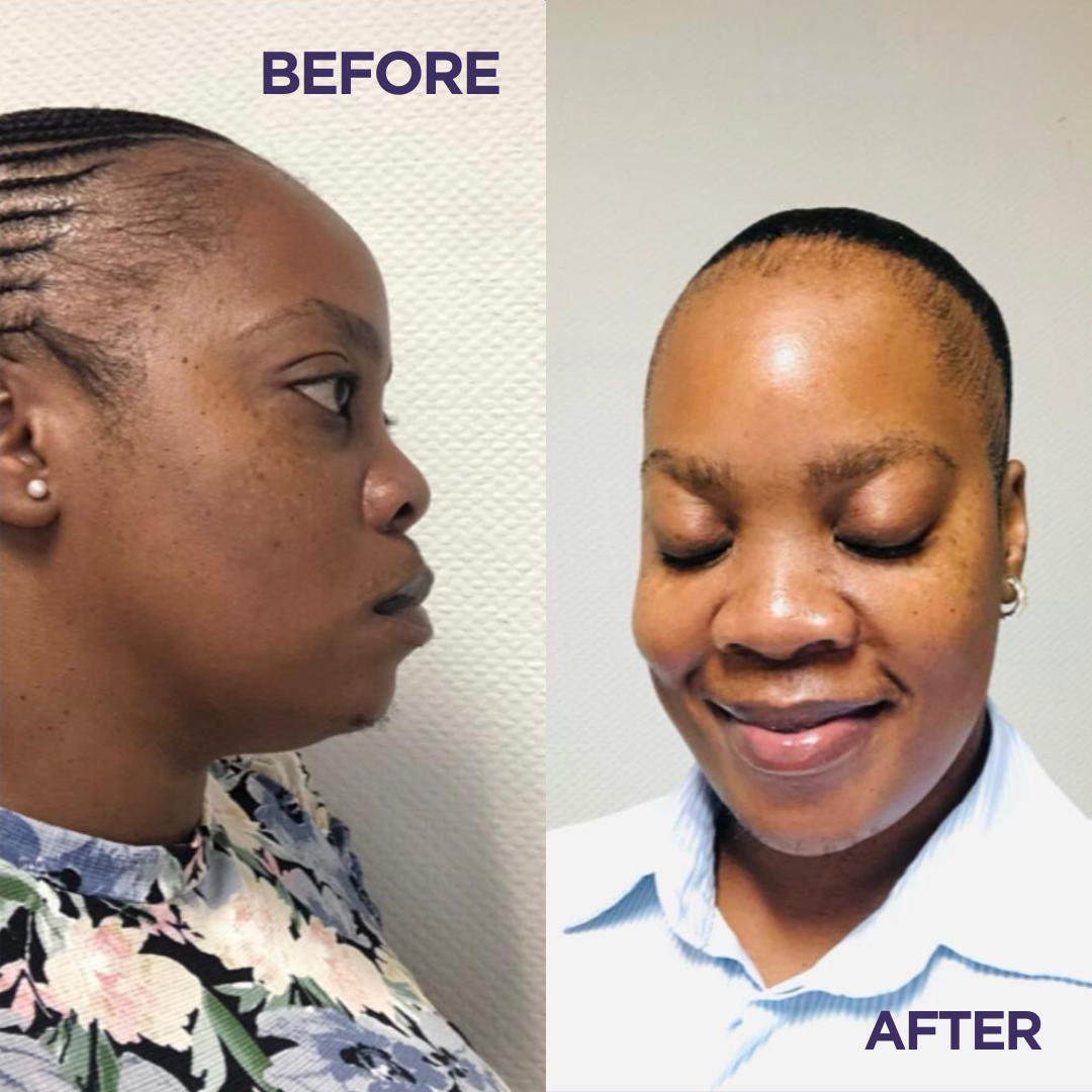 Ultra Skin Brightening Collagen